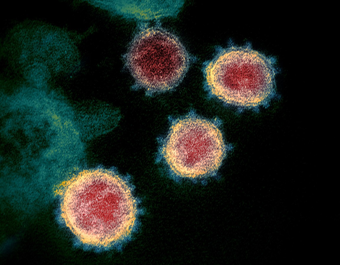 Coronavirus. 169 nuovi casi, un decesso