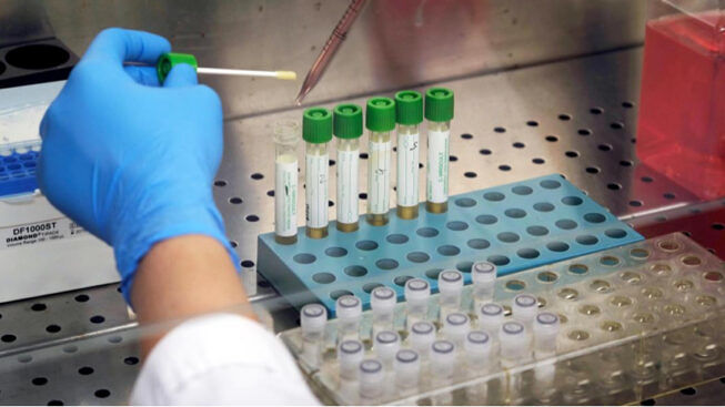 Test sierologici rapidi, da domani oltre 90.000 in distribuzione alle aziende sanitarie