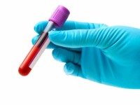 Coronavirus, ecco chi sarà sottoposto ai primi test sierologici